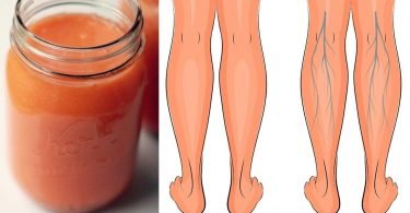 Jugos para la circulación de las varices