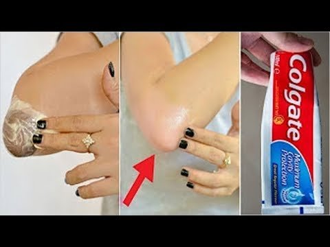 Como blanquear las rodillas con pasta de dientes