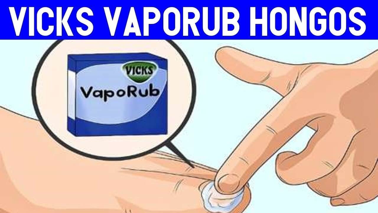 Vicks Vaporub hongos