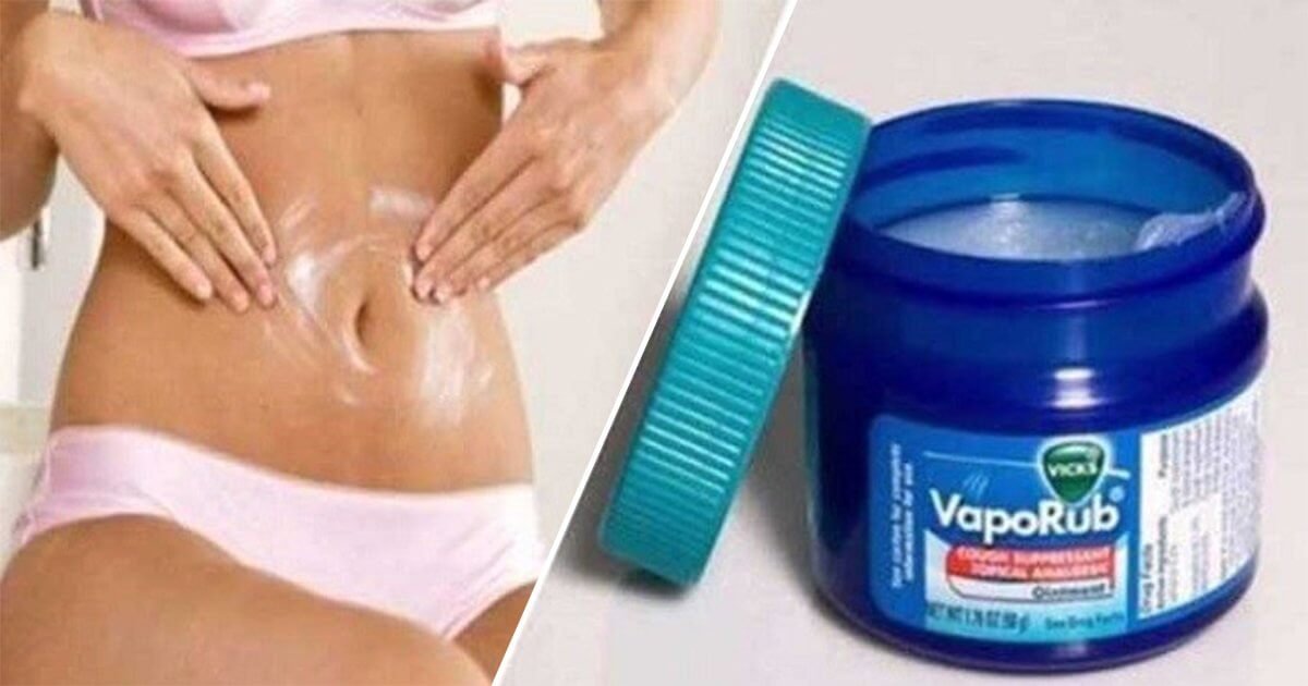 Vicks Vaporub Aliviar las agujetas