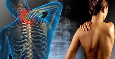 Remedios caseros para aliviar el dolor de la fibromialgia