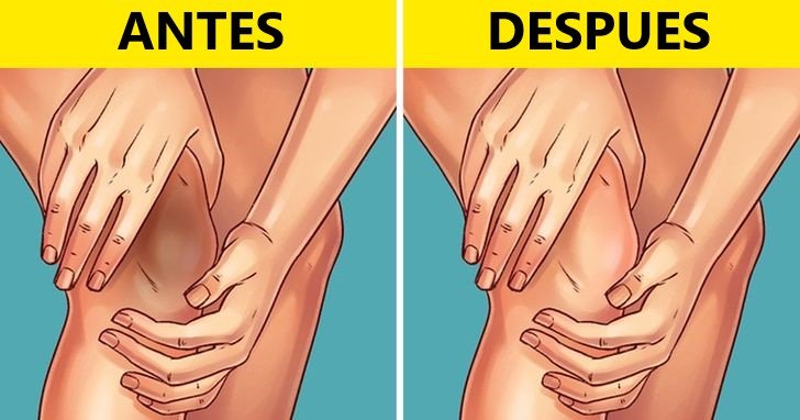 blanquear rodillas y codos oscuros