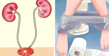 Remedios caseros para la infeccion de orina