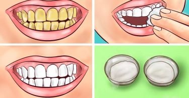 como blanquear dientes amarillos en casa con este remedio casero